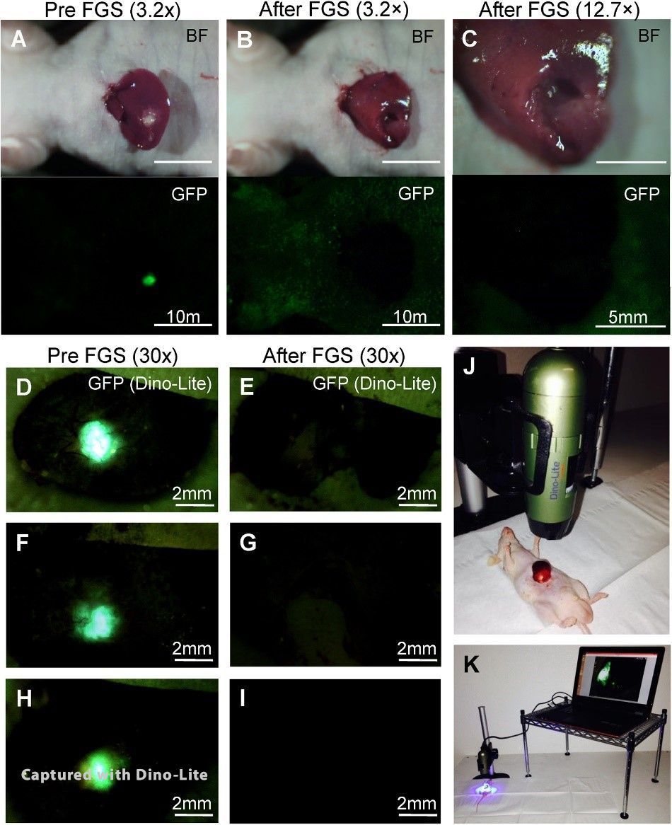 FGS of Liver Metastasis in Orthotopic Nude Mouse Models