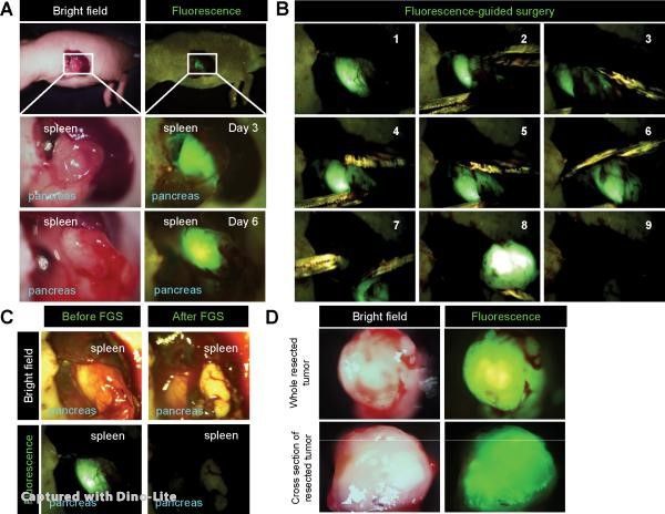 picture for Color coding cancer and stromal cells with genetic reporters enhances FGS