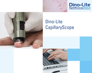 capillaryscope-brochure