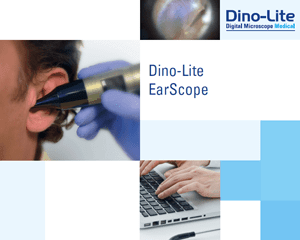 earscope-brochure