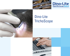 trichoscope-brochure